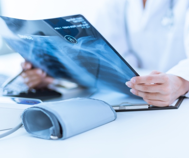 Médico avalia radiografia de paciente. Foto: Divulgação