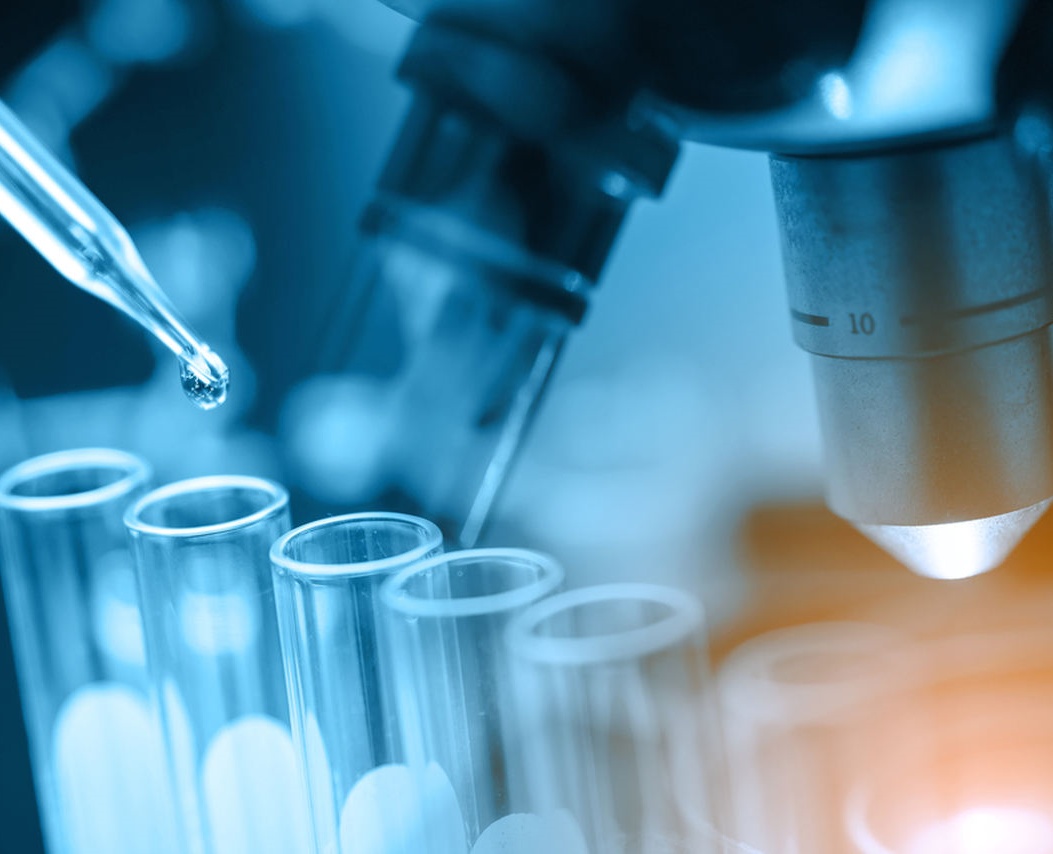 Exames laboratoriais são utilizados para a detecção de doenças. Foto: Divulgação